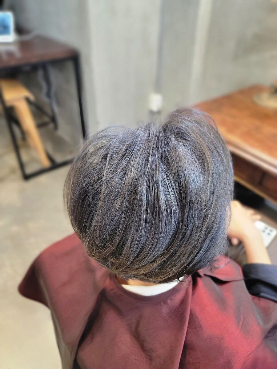 현재 단계 시술 후 모습