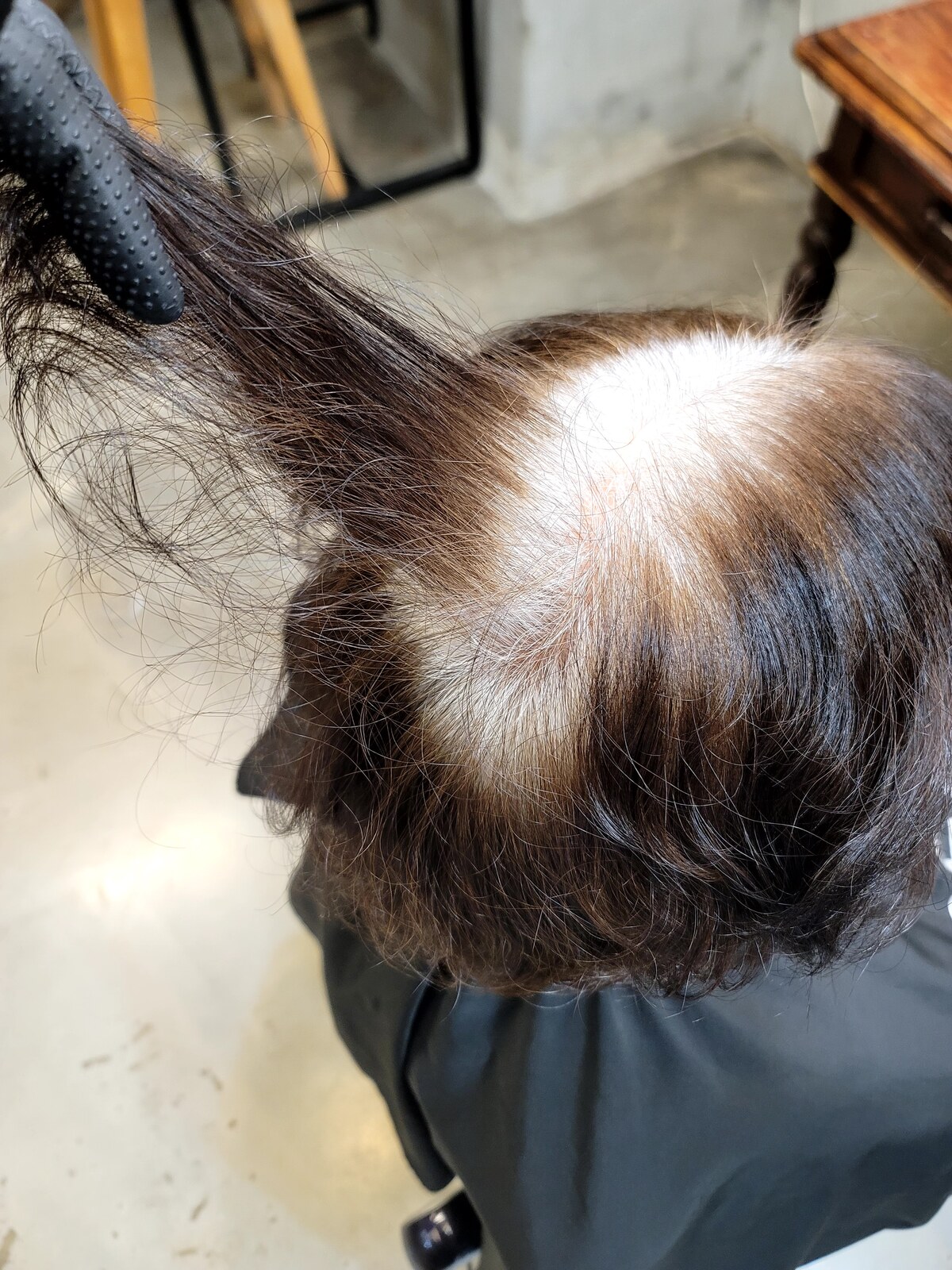 시술 전 정면에서 본 기존 염색 모발